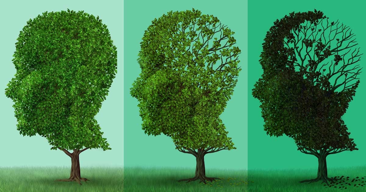 3-stages-of-Alzheimers-Disease